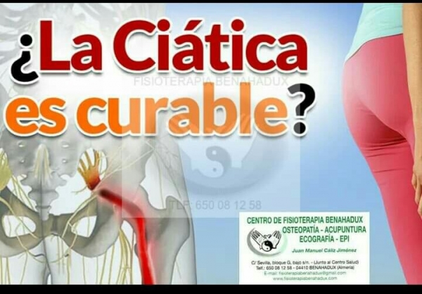 Es curable la ciática