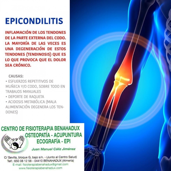 INFOGRAFIA EN EPICONDILITIS