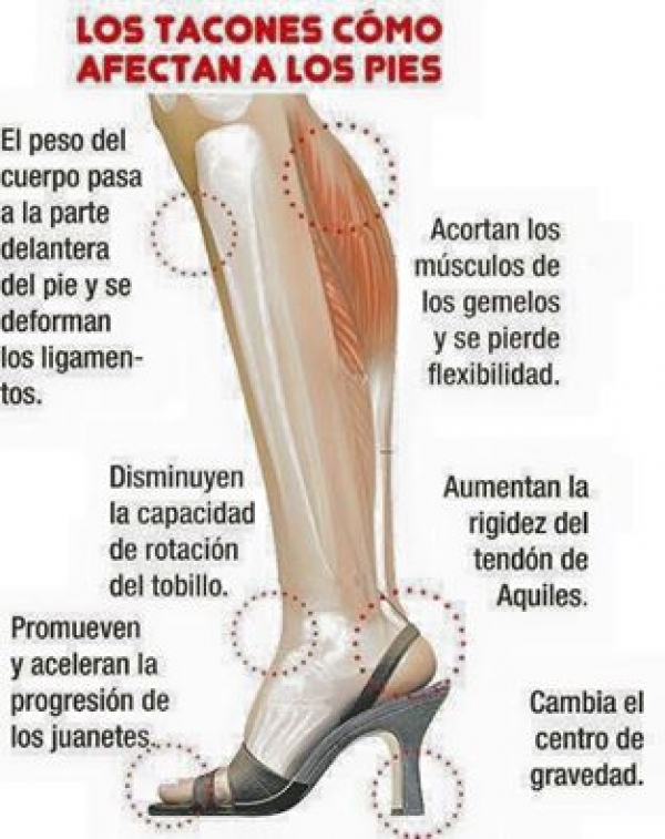 COMO AFECTAN LOS TACONES AL PIE