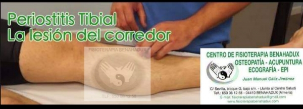 Periostitis tibial o rodilla del corredor