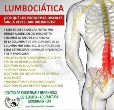 Lumbociatica