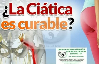 La ciática tiene cura