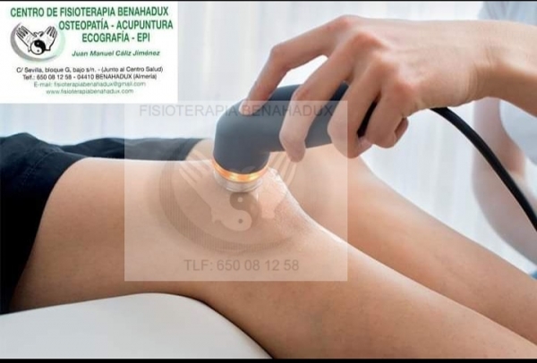 Fisioterapia y dolor de rodilla