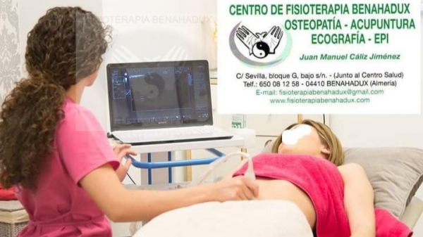 Eficacia de fisioterapia en la diastasis abdominal