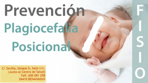 Importacia de la Osteopatia en la torticolis y la plagiocefalea del recien nacido