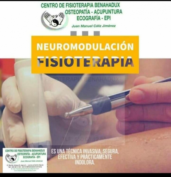 Neuromodulacion