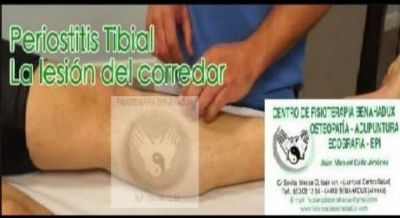 Periostitis tibial
